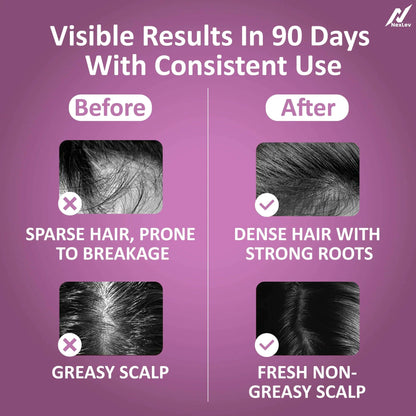 Luméra Hair Regrowth Red Light Comb