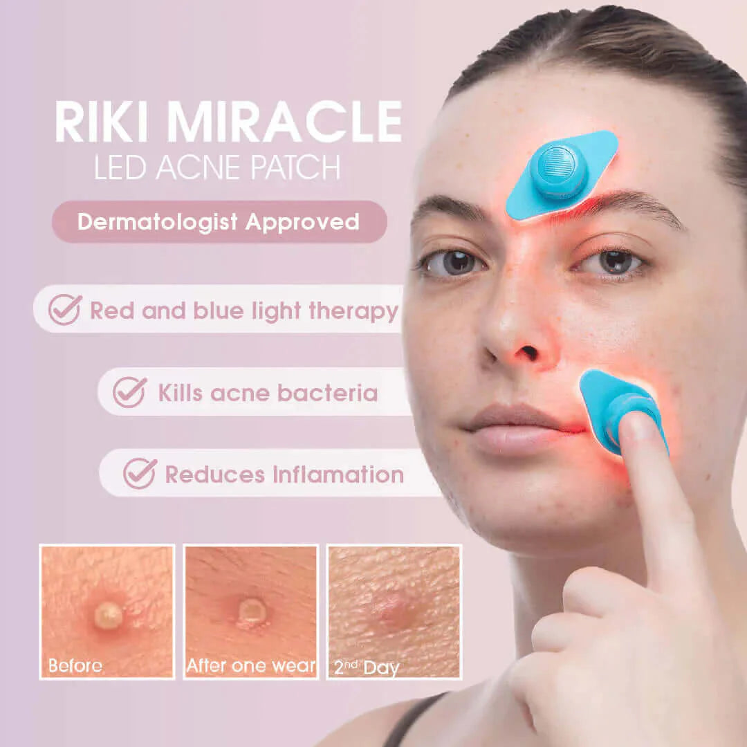 Acne Miracle
