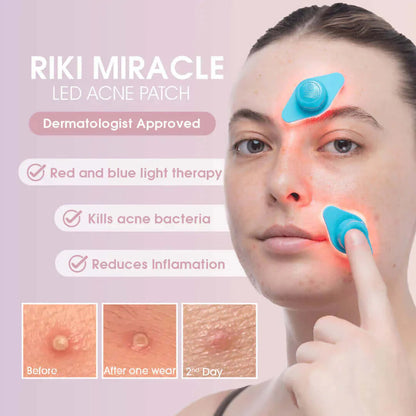 Acne Miracle